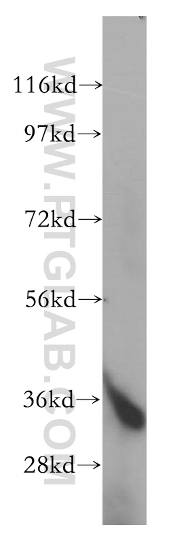 FN3K Antibody in Western Blot (WB)