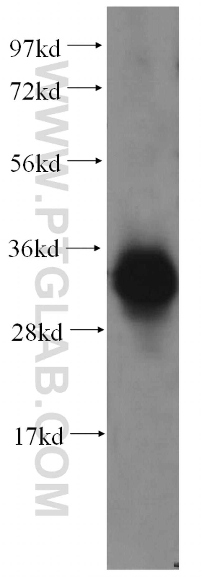 FN3K Antibody in Western Blot (WB)