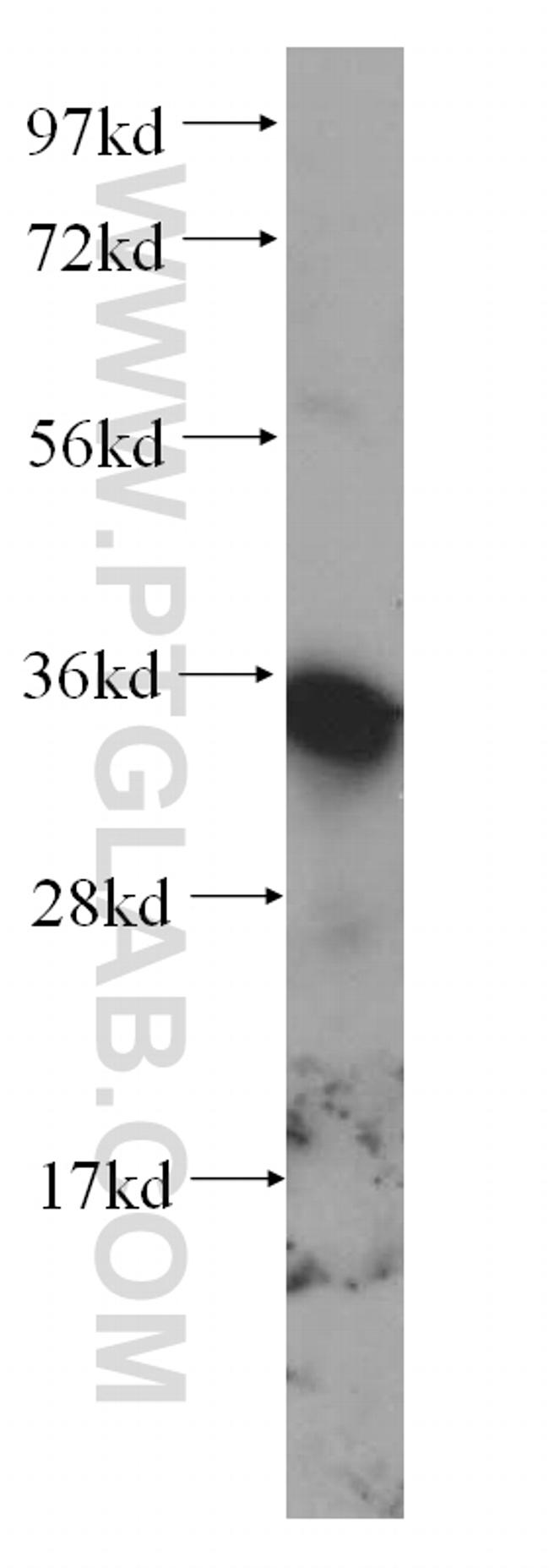 FN3K Antibody in Western Blot (WB)