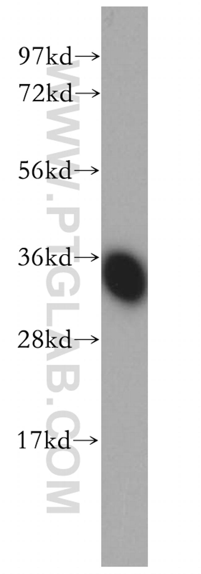 FN3K Antibody in Western Blot (WB)