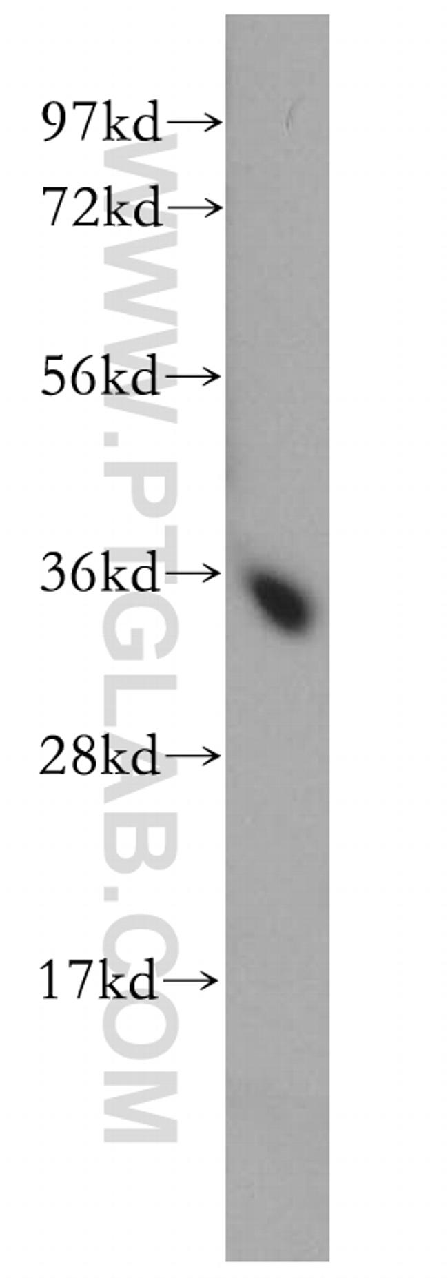 FN3K Antibody in Western Blot (WB)