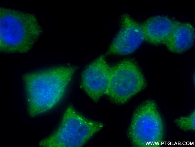 APPL2 Antibody in Immunocytochemistry (ICC/IF)