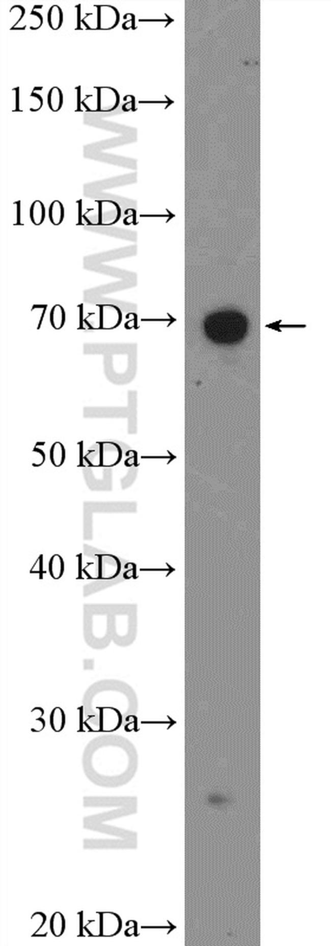 CHST15 Antibody in Western Blot (WB)