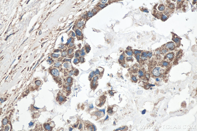 GLUD1 Antibody in Immunohistochemistry (Paraffin) (IHC (P))