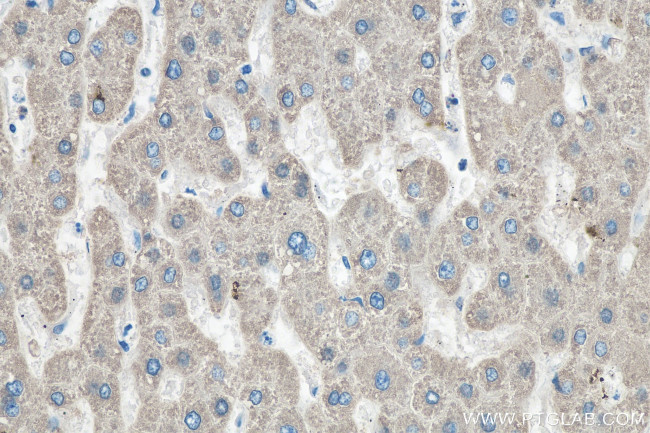 GLUD1 Antibody in Immunohistochemistry (Paraffin) (IHC (P))