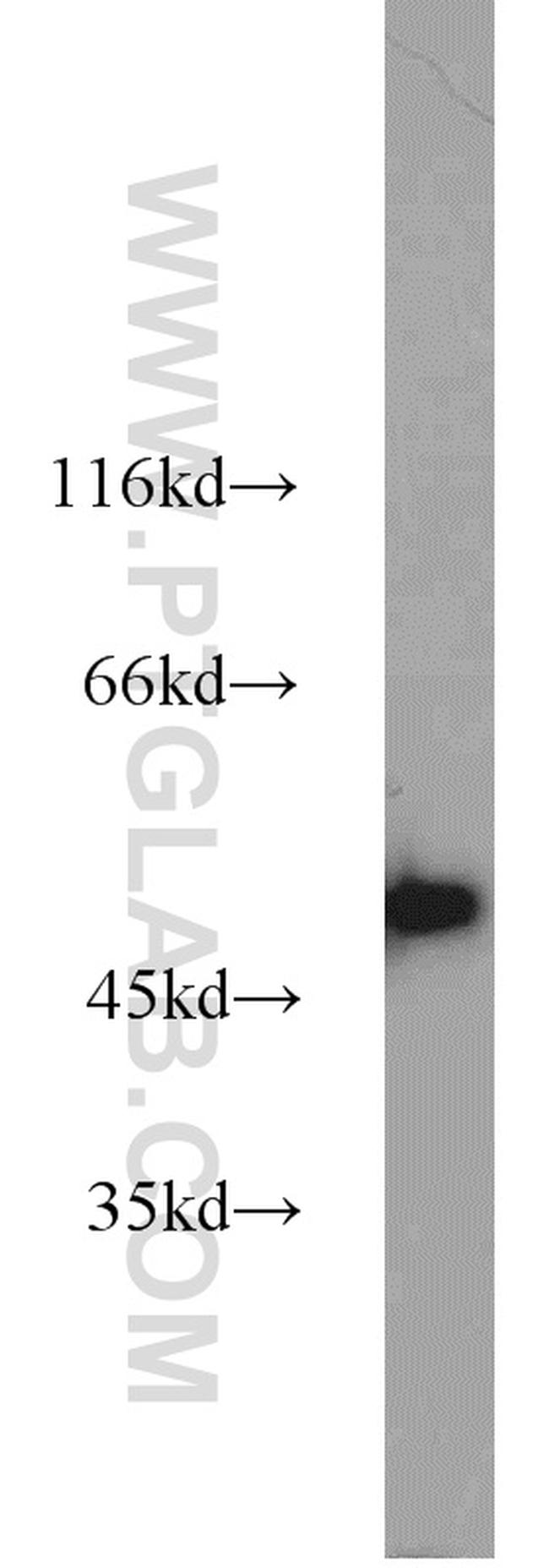 GLUD1 Antibody in Western Blot (WB)