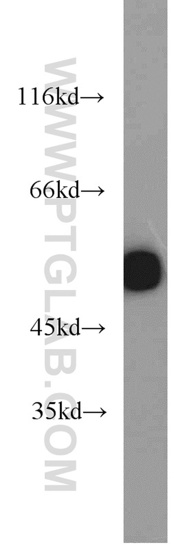 GLUD1 Antibody in Western Blot (WB)