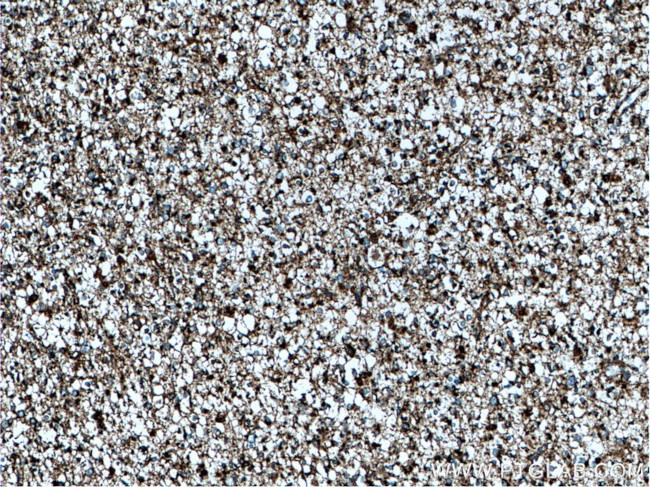 GLUD1 Antibody in Immunohistochemistry (Paraffin) (IHC (P))