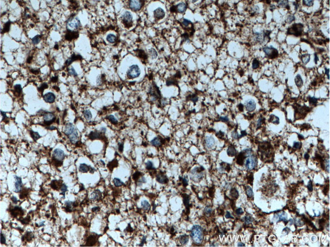 GLUD1 Antibody in Immunohistochemistry (Paraffin) (IHC (P))