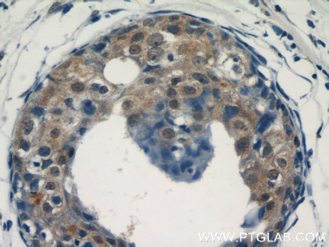 ACK1 Antibody in Immunohistochemistry (Paraffin) (IHC (P))