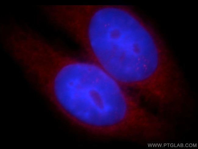 WASL Antibody in Immunocytochemistry (ICC/IF)