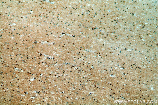 WASL Antibody in Immunohistochemistry (Paraffin) (IHC (P))