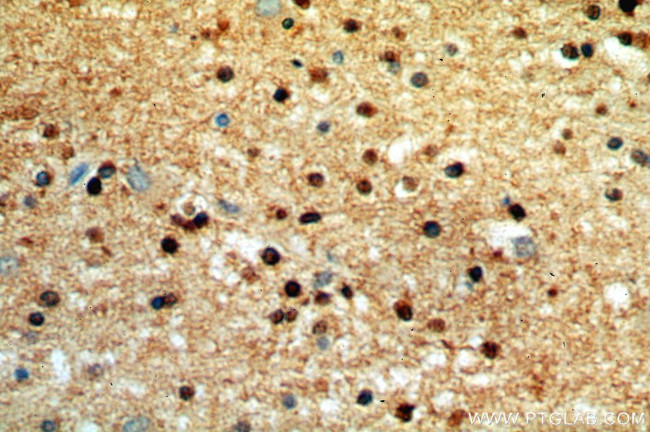 WASL Antibody in Immunohistochemistry (Paraffin) (IHC (P))