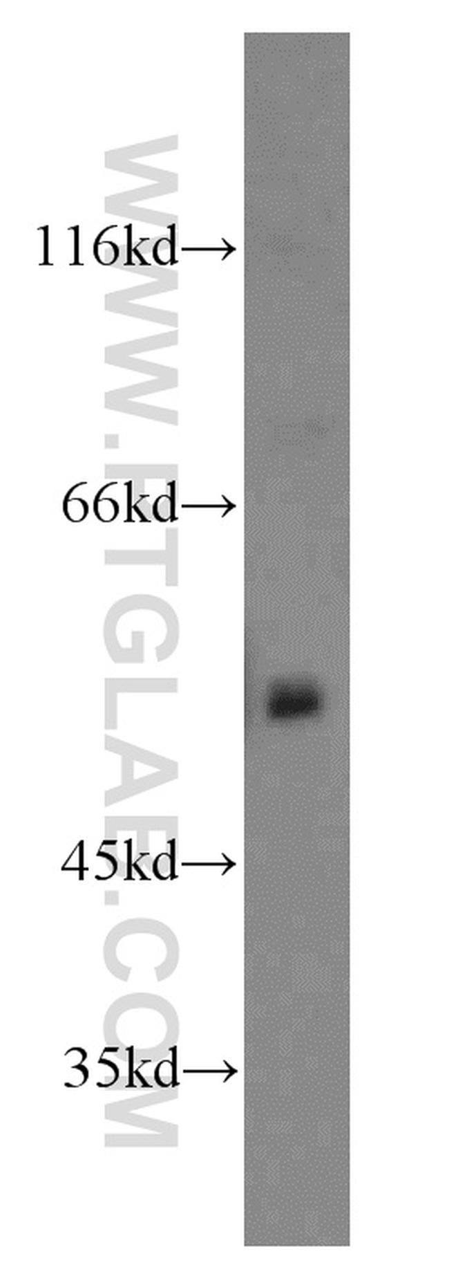 WASL Antibody in Western Blot (WB)