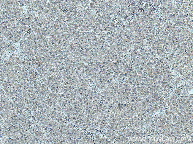 NFAM1 Antibody in Immunohistochemistry (Paraffin) (IHC (P))