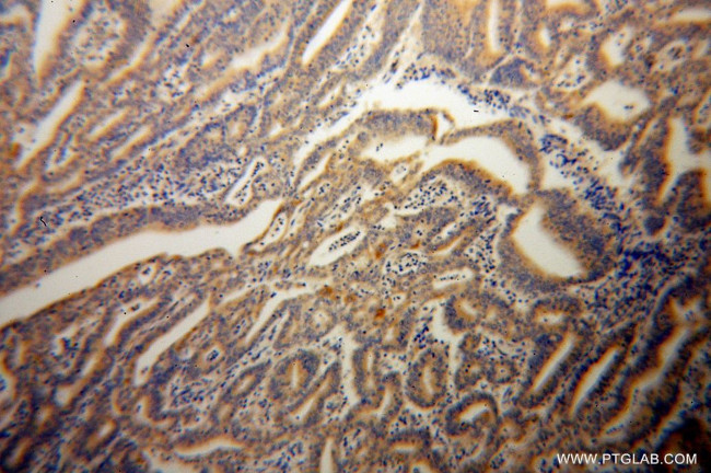 Caspase 10/p23/17/p12 Antibody in Immunohistochemistry (Paraffin) (IHC (P))