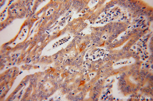 Caspase 10/p23/17/p12 Antibody in Immunohistochemistry (Paraffin) (IHC (P))