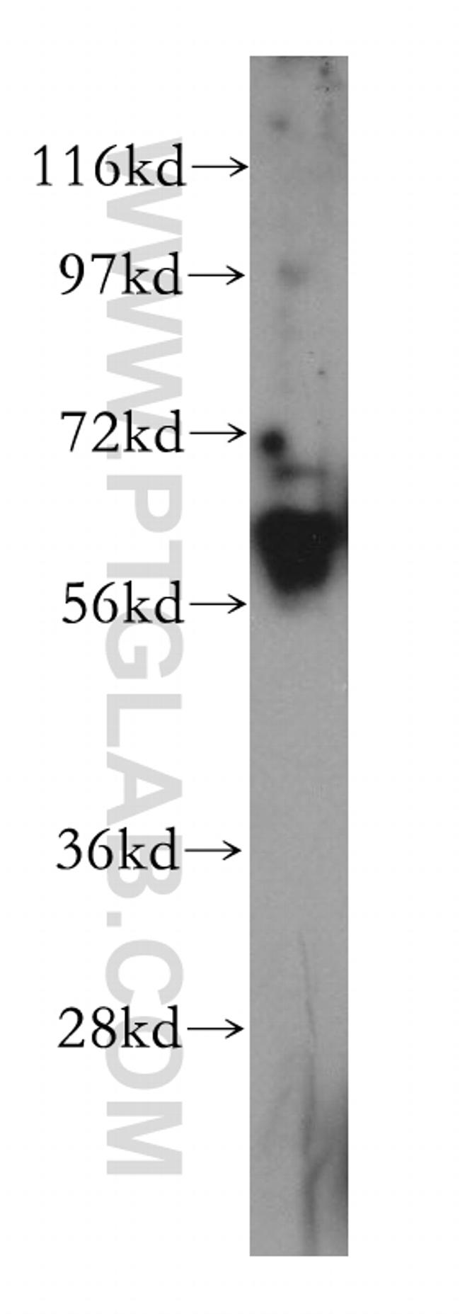 Caspase 10/p23/17/p12 Antibody in Western Blot (WB)