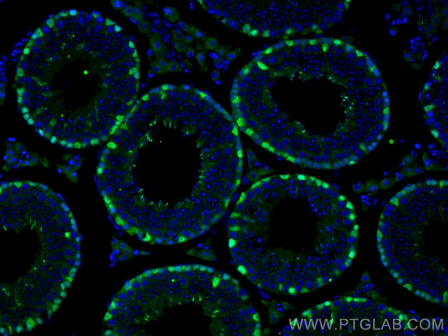 DMRT1 Antibody in Immunohistochemistry (Paraffin) (IHC (P))