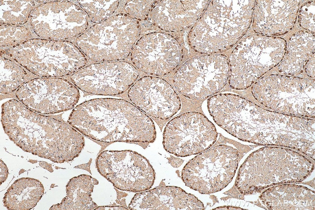 DMRT1 Antibody in Immunohistochemistry (Paraffin) (IHC (P))