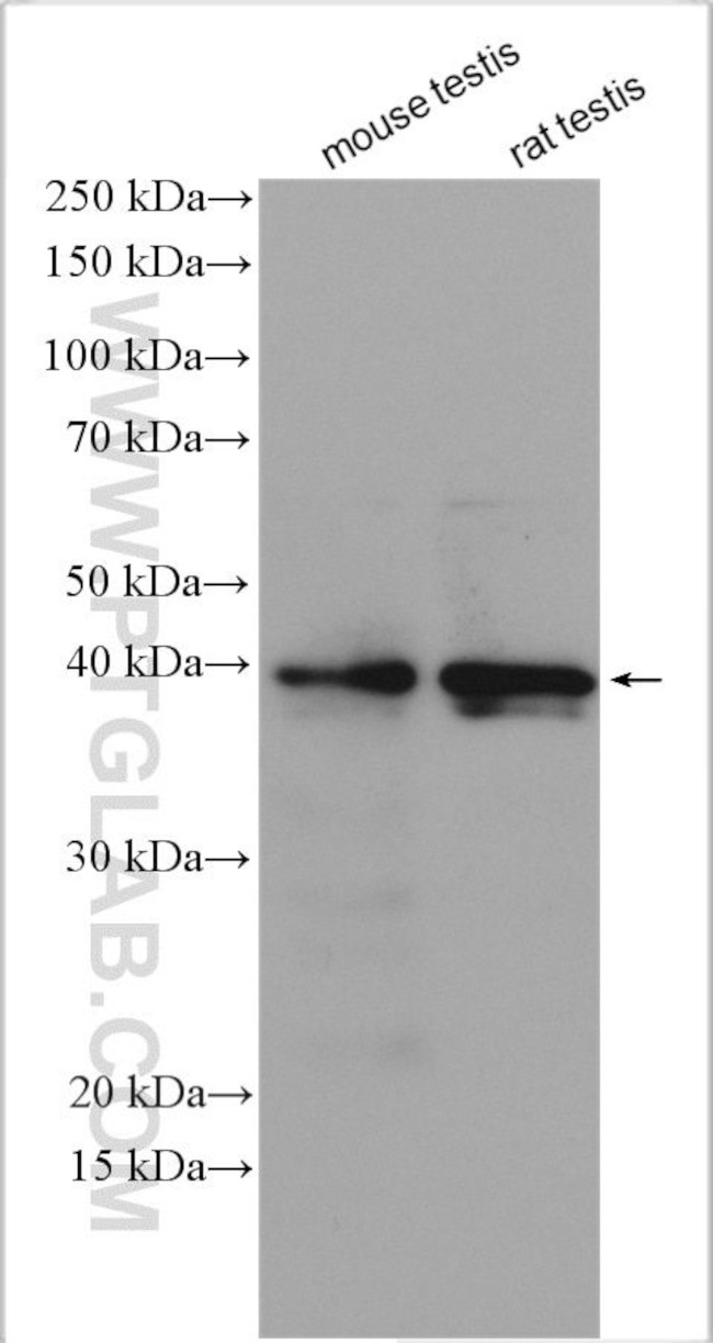 DMRT1 Antibody in Western Blot (WB)