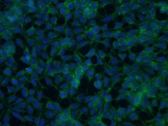 SLC38A3 Antibody in Immunocytochemistry (ICC/IF)