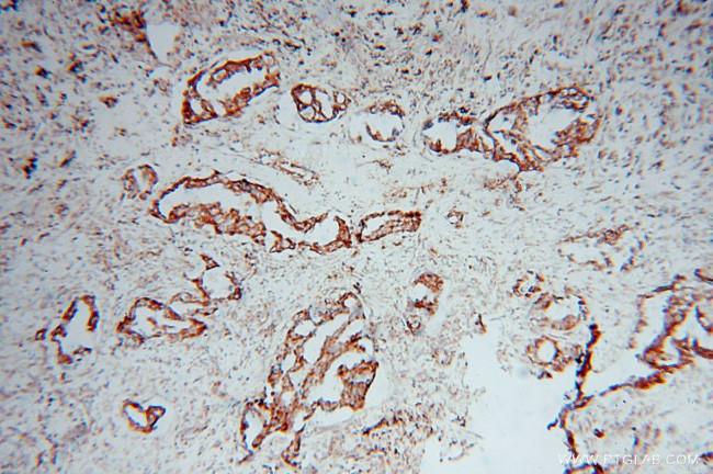 SLC38A3 Antibody in Immunohistochemistry (Paraffin) (IHC (P))