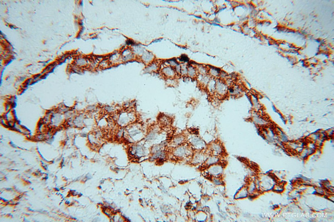 SLC38A3 Antibody in Immunohistochemistry (Paraffin) (IHC (P))