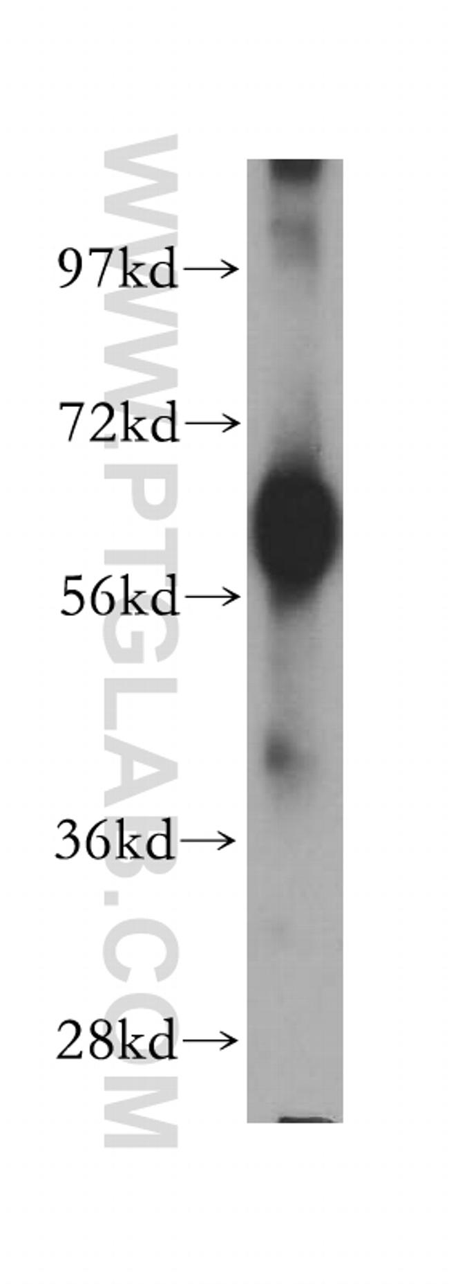 SLC38A3 Antibody in Western Blot (WB)