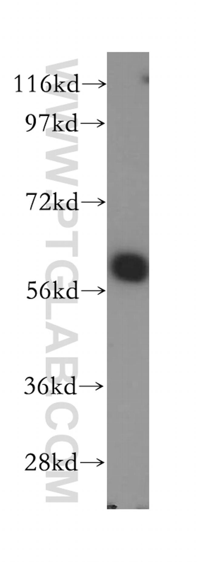 SLC38A3 Antibody in Western Blot (WB)