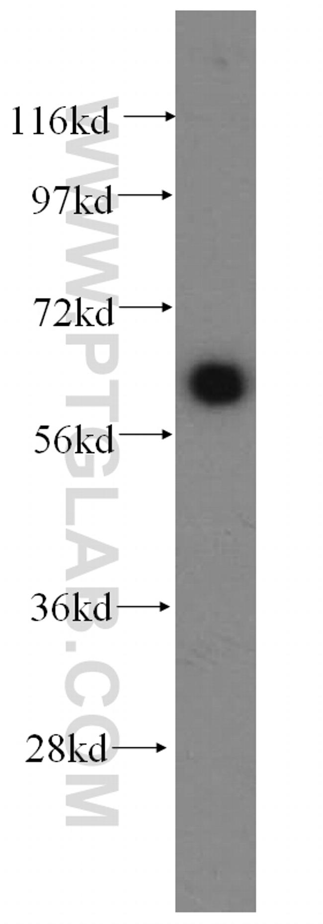 SLC38A3 Antibody in Western Blot (WB)