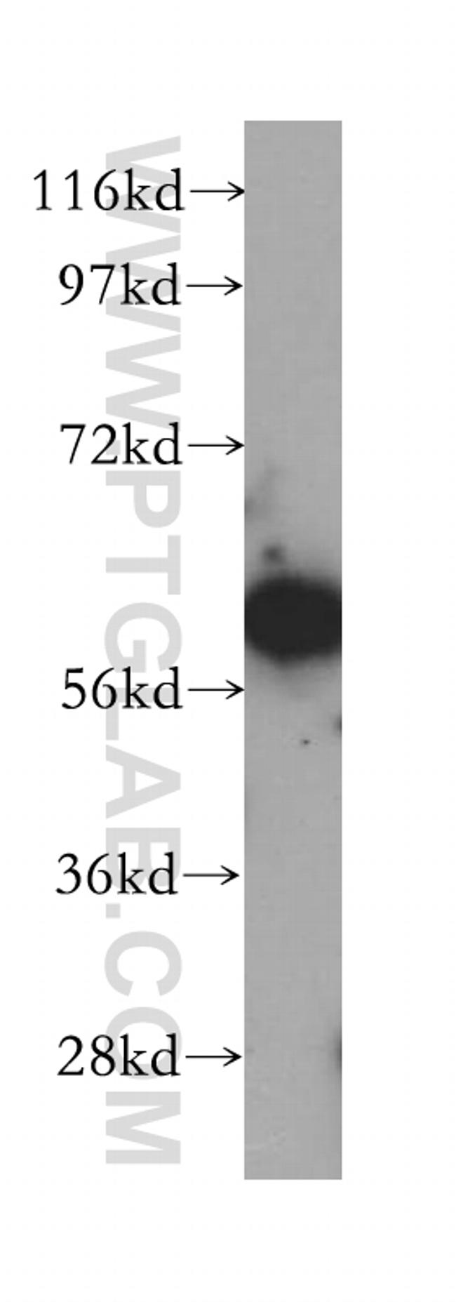 SLC38A3 Antibody in Western Blot (WB)