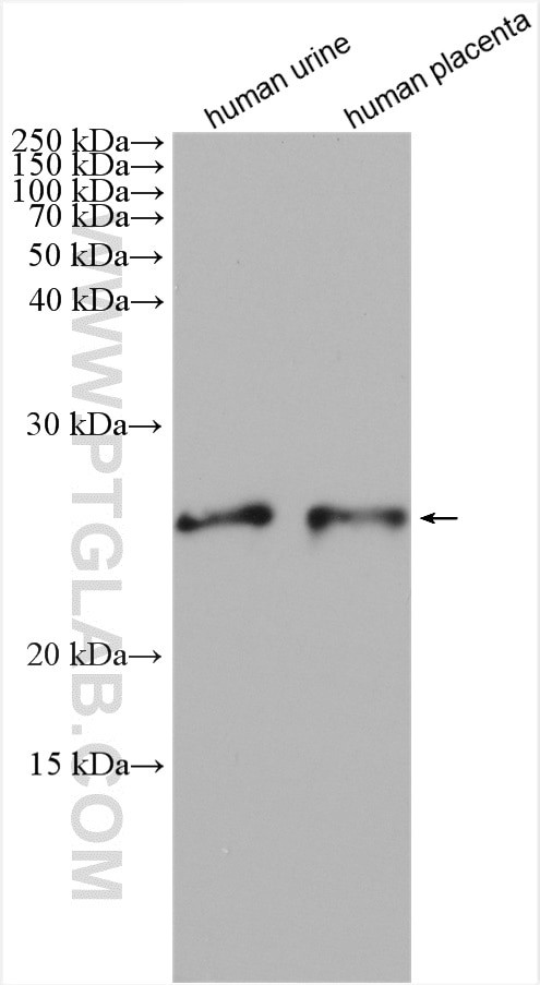 SOD3 Antibody in Western Blot (WB)