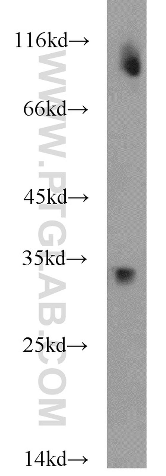 SOD3 Antibody in Western Blot (WB)