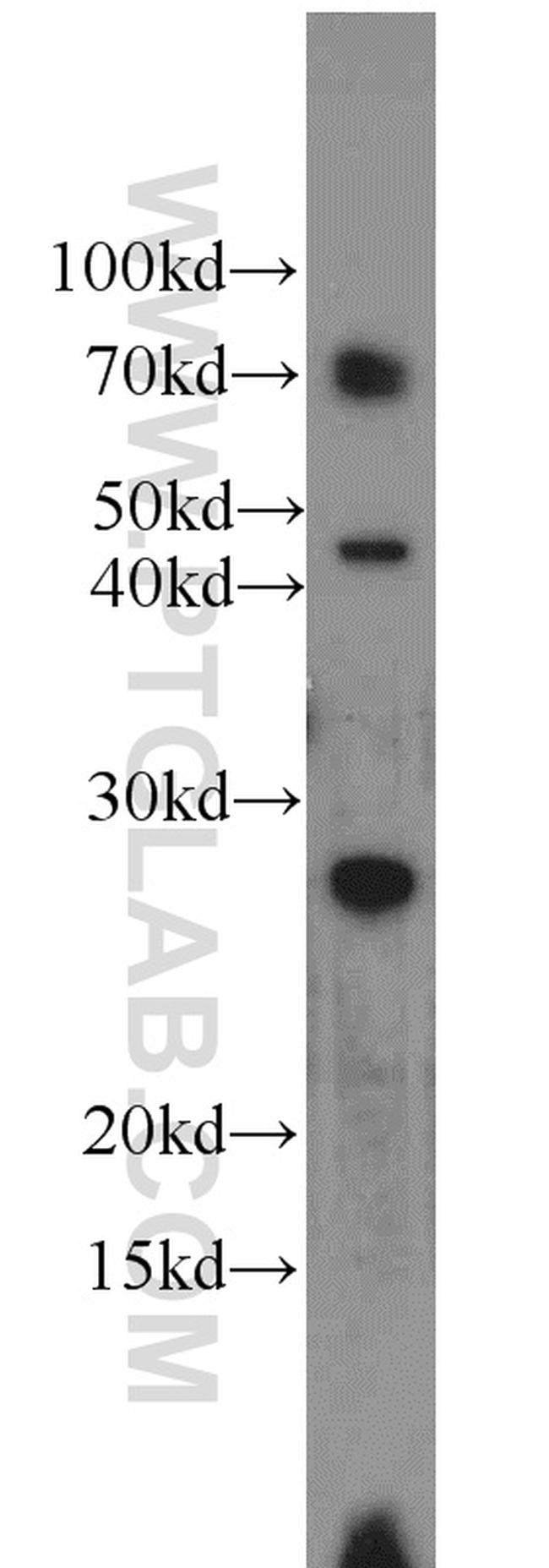 SOD3 Antibody in Western Blot (WB)