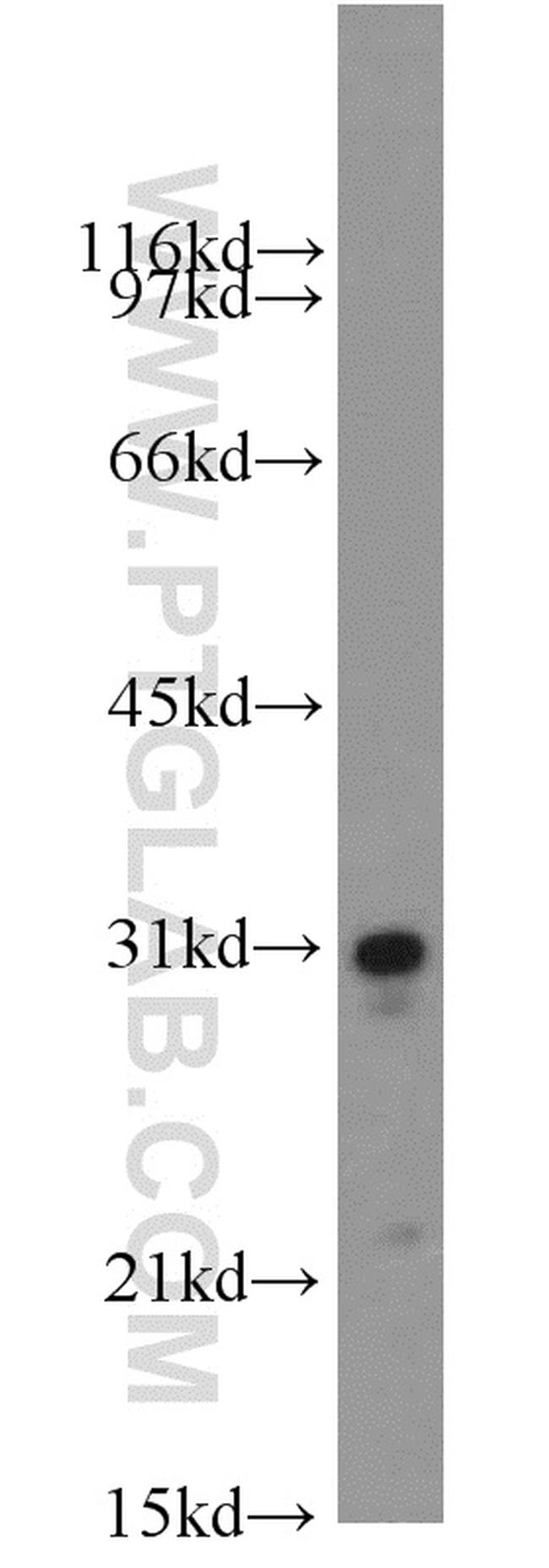 SOD3 Antibody in Western Blot (WB)