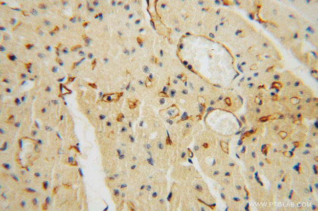 Thrombomodulin Antibody in Immunohistochemistry (Paraffin) (IHC (P))