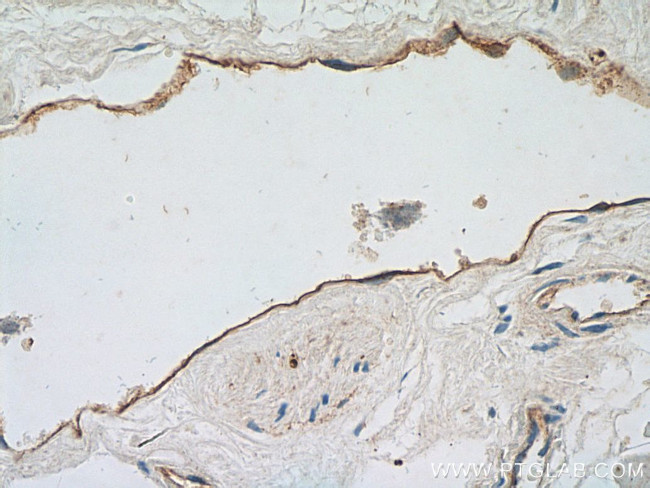 Thrombomodulin Antibody in Immunohistochemistry (Paraffin) (IHC (P))