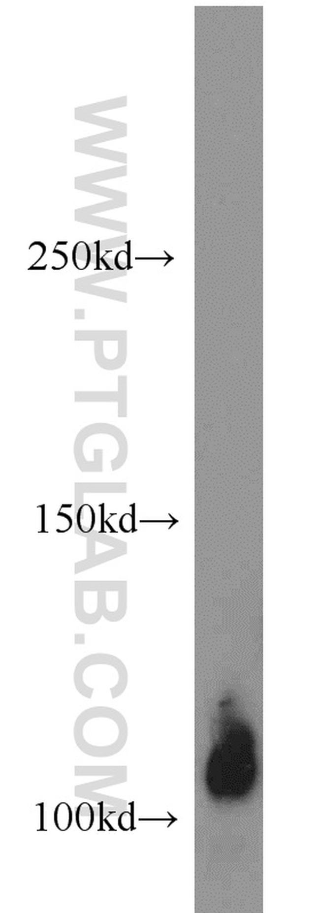 Thrombomodulin Antibody in Western Blot (WB)