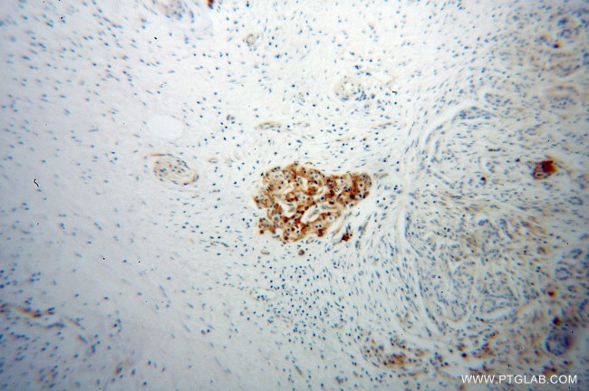 VWA1 Antibody in Immunohistochemistry (Paraffin) (IHC (P))