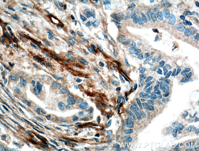 VWA1 Antibody in Immunohistochemistry (Paraffin) (IHC (P))