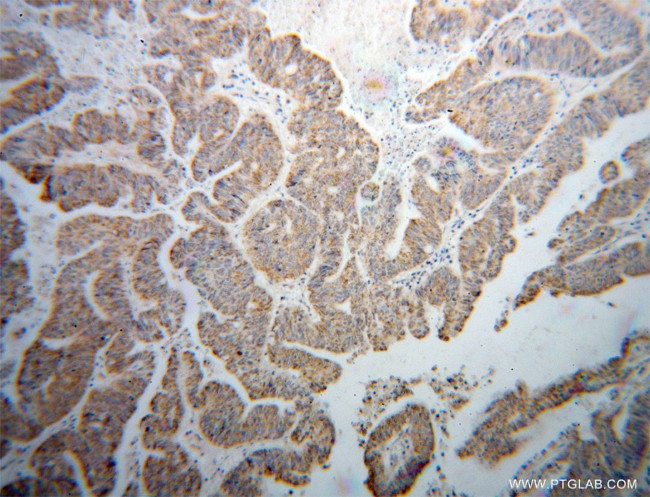 BCO2 Antibody in Immunohistochemistry (Paraffin) (IHC (P))