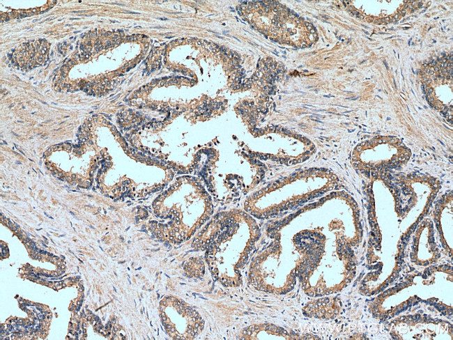 BCO2 Antibody in Immunohistochemistry (Paraffin) (IHC (P))