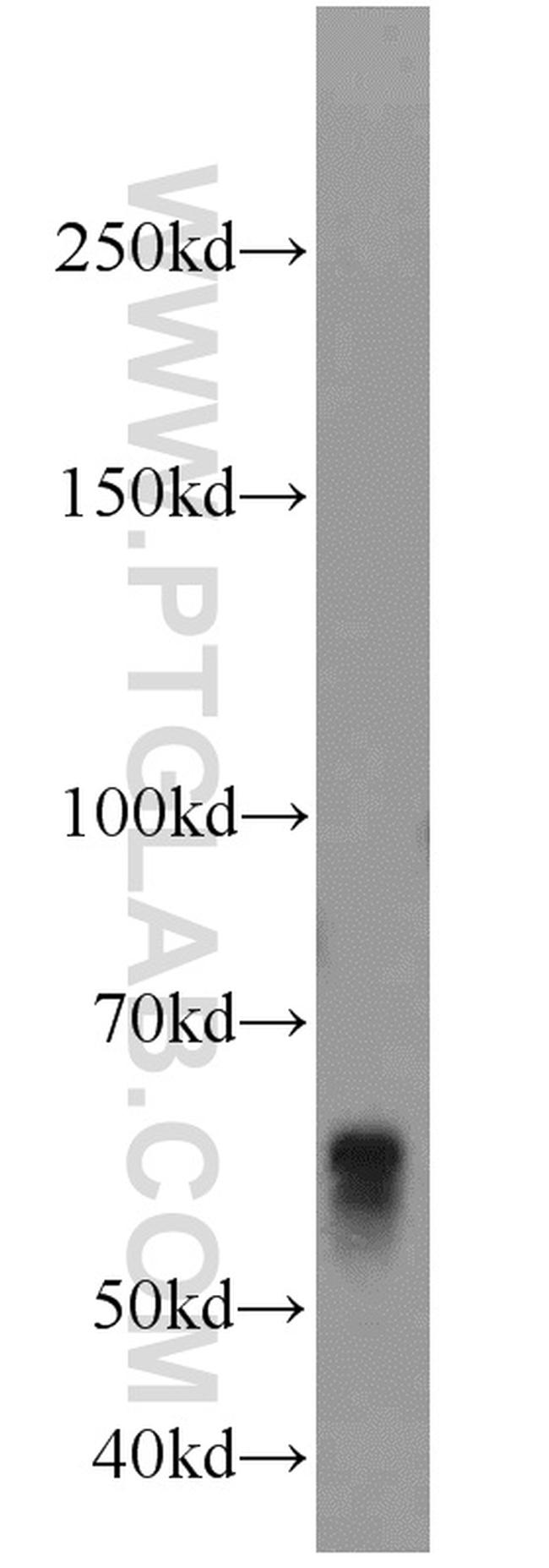 BCO2 Antibody in Western Blot (WB)