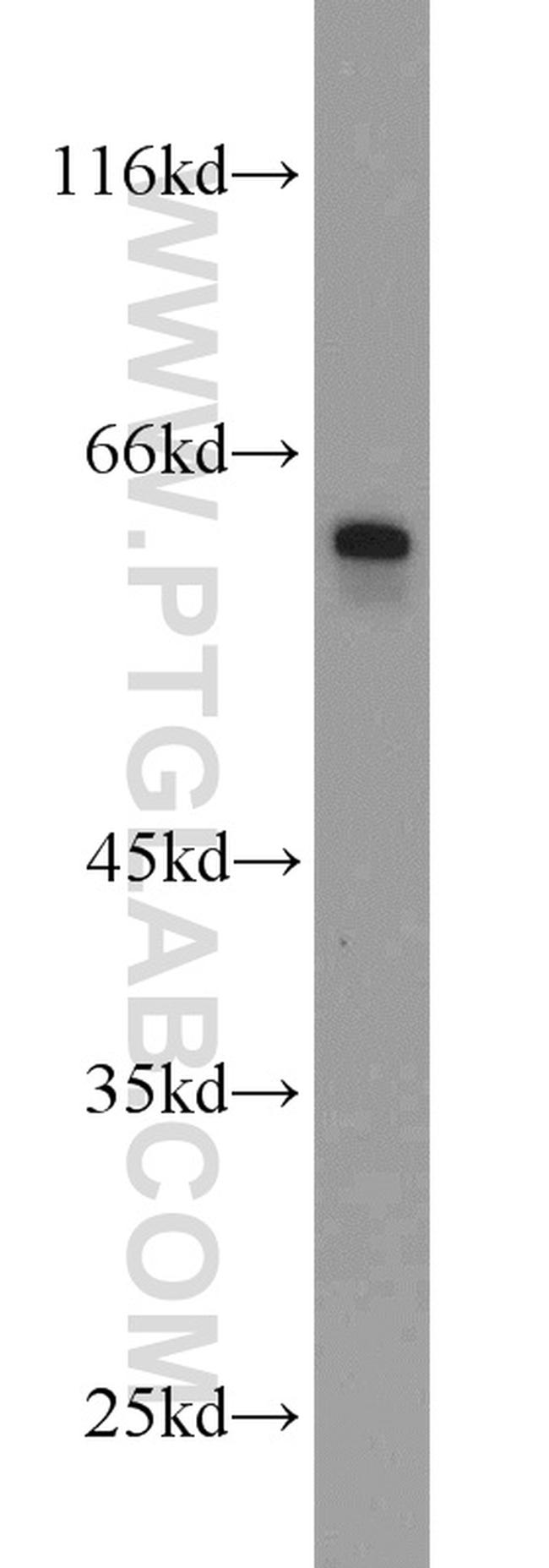 BCO2 Antibody in Western Blot (WB)