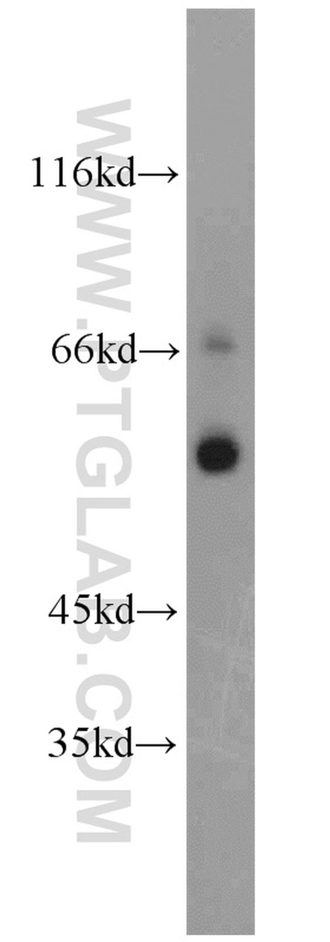 PGT Antibody in Western Blot (WB)