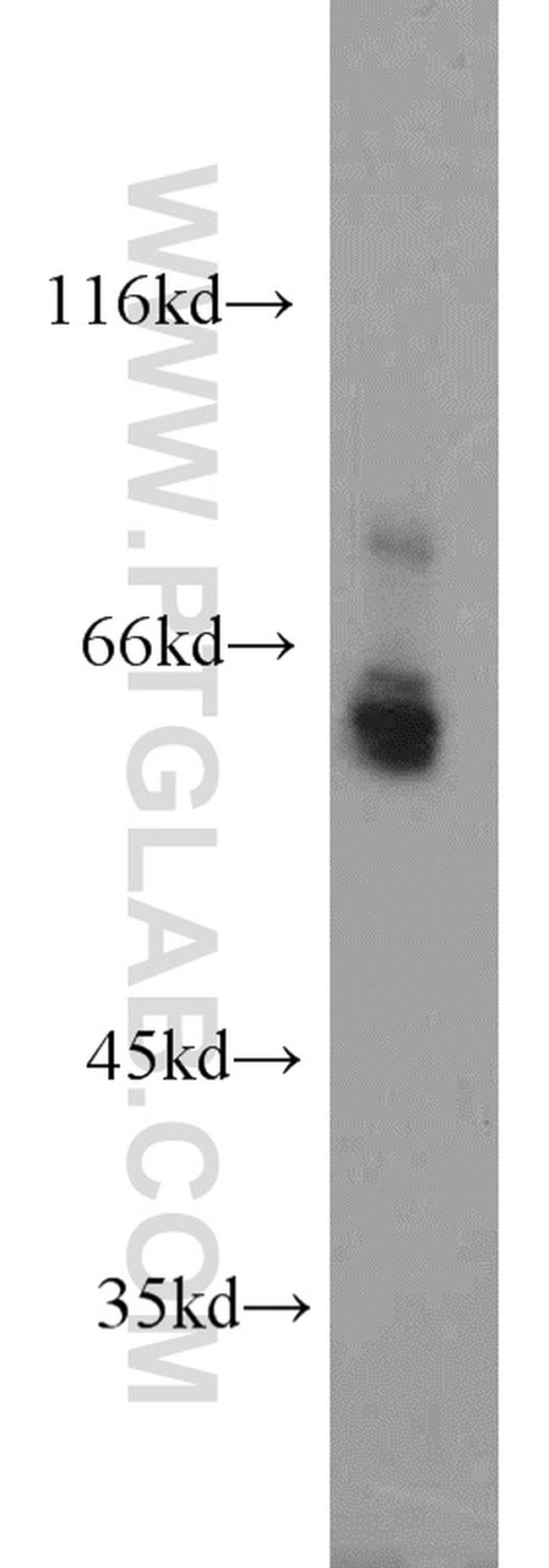 PGT Antibody in Western Blot (WB)