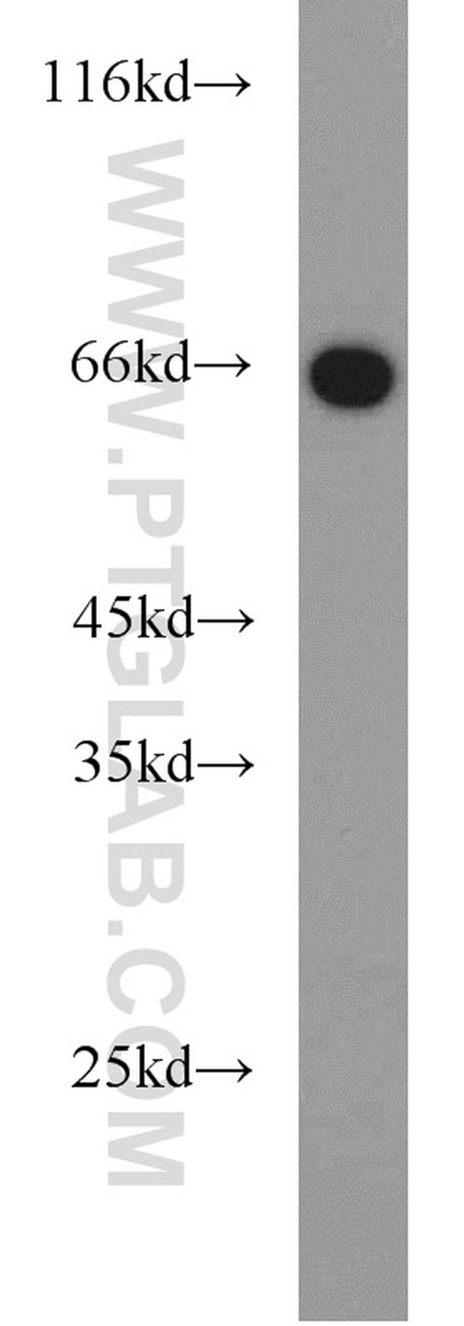 PGT Antibody in Western Blot (WB)