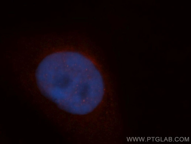 ADAR1 Antibody in Immunocytochemistry (ICC/IF)