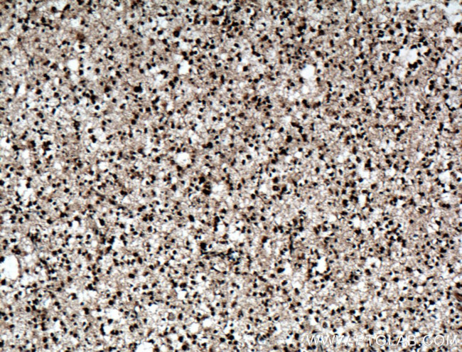 ADAR1 Antibody in Immunohistochemistry (Paraffin) (IHC (P))